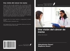Buchcover von Una visión del cáncer de mama