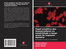 Copertina di Papel preditivo dos biomarcadores na estabilidade a longo prazo do implante dentário