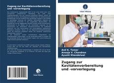 Buchcover von Zugang zur Kavitätenvorbereitung und -vorverlegung