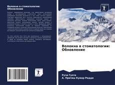 Bookcover of Волокна в стоматологии: Обновление