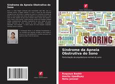 Bookcover of Síndrome da Apneia Obstrutiva do Sono