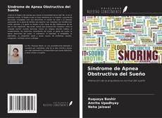 Síndrome de Apnea Obstructiva del Sueño kitap kapağı