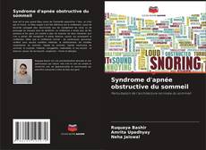 Capa do livro de Syndrome d'apnée obstructive du sommeil 