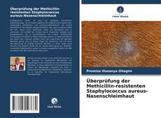 Capa do livro de Überprüfung der Methicillin-resistenten Staphylococcus aureus-Nasenschleimhaut 