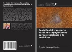 Copertina di Revisión del transporte nasal de Staphylococcus aureus resistente a la meticilina