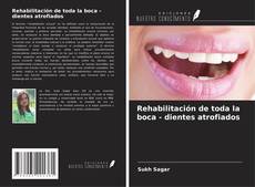 Capa do livro de Rehabilitación de toda la boca - dientes atrofiados 