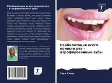 Обложка Реабилитация всего полости рта - атрофированные зубы