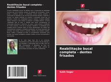 Capa do livro de Reabilitação bucal completa - dentes frisados 