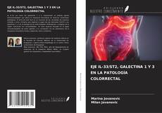Bookcover of EJE IL-33/ST2, GALECTINA 1 Y 3 EN LA PATOLOGÍA COLORRECTAL