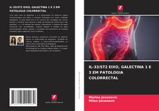 Copertina di IL-33/ST2 EIXO, GALECTINA 1 E 3 EM PATOLOGIA COLORRECTAL