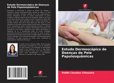 Borítókép a  Estudo Dermoscópico de Doenças de Pele Papulosquâmicas - hoz