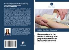 Buchcover von Dermoskopische Untersuchung von papulosquamösen Hautkrankheiten