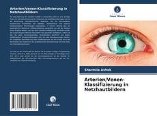 Buchcover von Arterien/Venen-Klassifizierung in Netzhautbildern