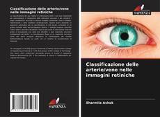Bookcover of Classificazione delle arterie/vene nelle immagini retiniche