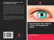 Capa do livro de Classificação das artérias / veias em imagens de retina 