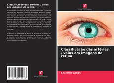 Couverture de Classificação das artérias / veias em imagens de retina