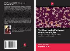 Обложка Biofilme endodôntico e sua erradicação