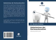 Bookcover of Geheimnisse der Kariesexkavation