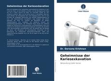 Couverture de Geheimnisse der Kariesexkavation