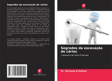 Borítókép a  Segredos da escavação de cáries - hoz