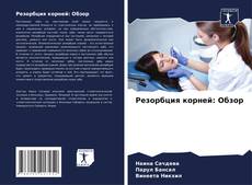 Bookcover of Резорбция корней: Обзор