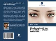 Bookcover of Blepharoplastik des Oberlids bei älteren Menschen