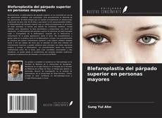 Bookcover of Blefaroplastia del párpado superior en personas mayores