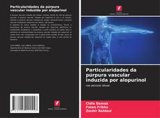 Buchcover von Particularidades da púrpura vascular induzida por alopurinol