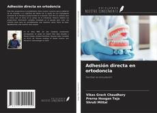 Bookcover of Adhesión directa en ortodoncia