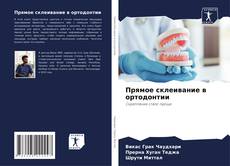 Bookcover of Прямое склеивание в ортодонтии