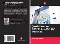 Bookcover of Trombocitopenia induzida por heparina no contexto dos cuidados intensivos