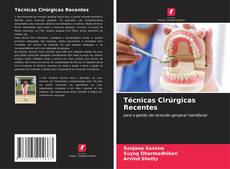 Bookcover of Técnicas Cirúrgicas Recentes