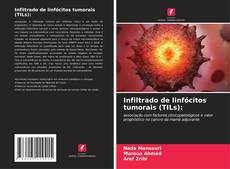 Обложка Infiltrado de linfócitos tumorais (TILs):