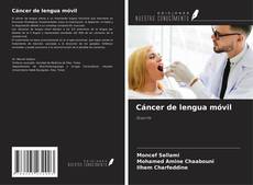 Capa do livro de Cáncer de lengua móvil 