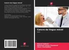 Buchcover von Cancro da língua móvel