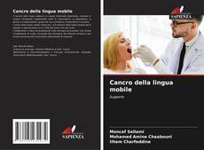 Copertina di Cancro della lingua mobile
