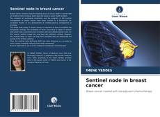 Buchcover von Sentinel node in breast cancer