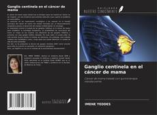 Ganglio centinela en el cáncer de mama kitap kapağı