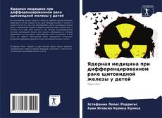Copertina di Ядерная медицина при дифференцированном раке щитовидной железы у детей