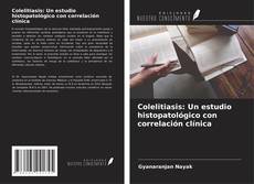 Capa do livro de Colelitiasis: Un estudio histopatológico con correlación clínica 