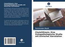 Portada del libro de Cholelithiasis: Eine histopathologische Studie mit klinischer Korrelation