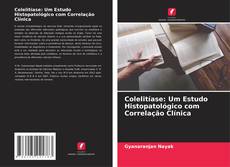 Bookcover of Colelitíase: Um Estudo Histopatológico com Correlação Clínica