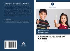 Buchcover von Anteriorer Kreuzbiss bei Kindern