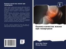 Capa do livro de Оценка качества жизни при гонартрозе 