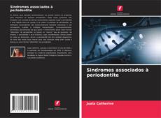 Bookcover of Sindromes associados à periodontite