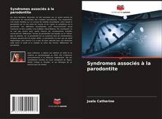 Buchcover von Syndromes associés à la parodontite