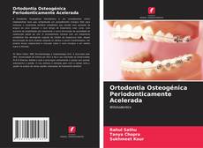 Borítókép a  Ortodontia Osteogénica Periodonticamente Acelerada - hoz