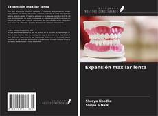 Bookcover of Expansión maxilar lenta
