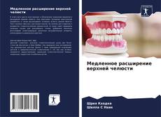 Buchcover von Медленное расширение верхней челюсти