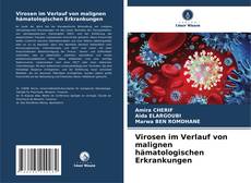Bookcover of Virosen im Verlauf von malignen hämatologischen Erkrankungen
